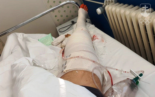 Pravá noha Erika Vlčeka ešte na nemocničnom lôžku v Dunajskej Strede. Od piatka predpoludním je Erik už doma v Komárne.
