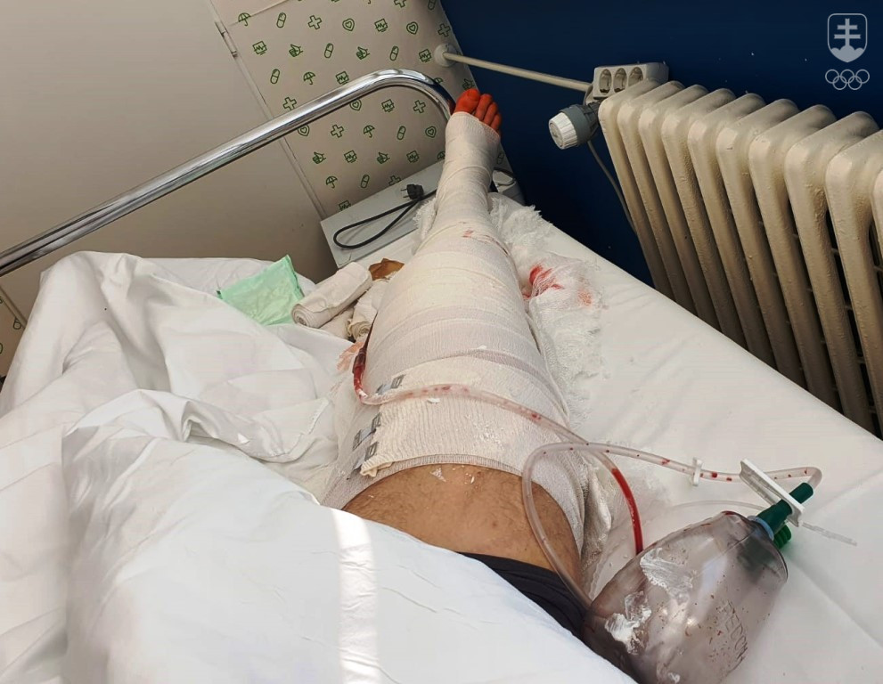Pravá noha Erika Vlčeka ešte na nemocničnom lôžku v Dunajskej Strede. Od piatka predpoludním je Erik už doma v Komárne.